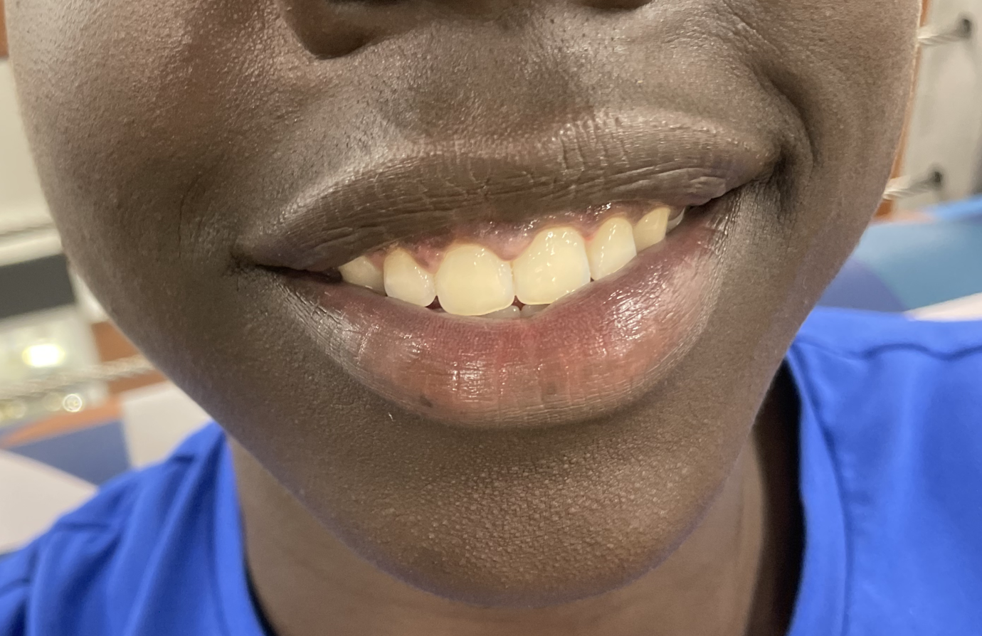 Smiles of Owatonna High School