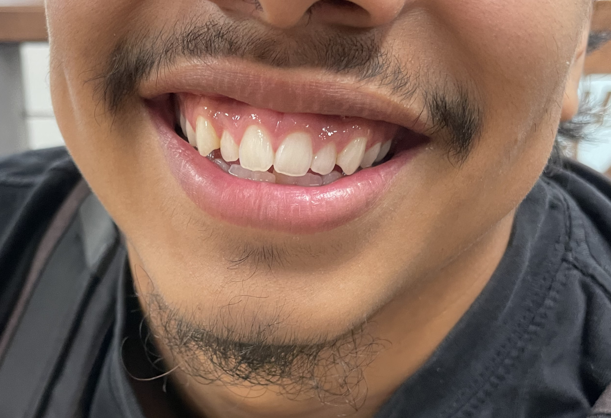 Smiles of Owatonna High School