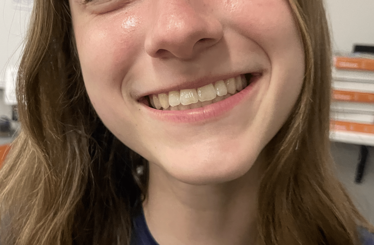 Smiles of Owatonna High School